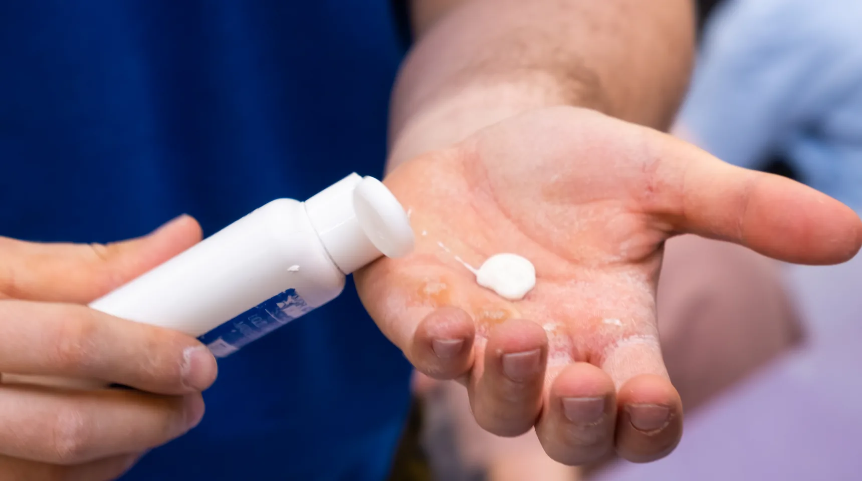Qué crema o pomada sirve para las verrugas genitales